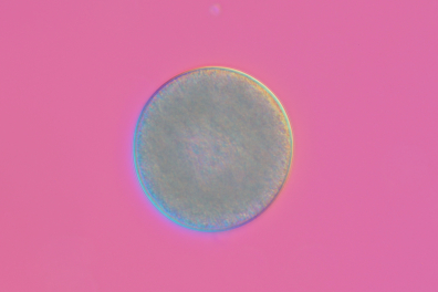 Ovule de Moule (Mytilus edulis) CIT x120